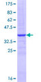 FUT4 / CD15 Protein - 12.5% SDS-PAGE Stained with Coomassie Blue.
