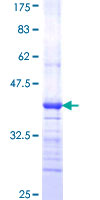 FUT5 Protein - 12.5% SDS-PAGE Stained with Coomassie Blue.