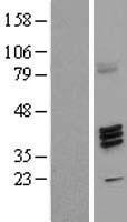 FUT7 Protein - Western validation with an anti-DDK antibody * L: Control HEK293 lysate R: Over-expression lysate