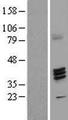 FUT7 Protein - Western validation with an anti-DDK antibody * L: Control HEK293 lysate R: Over-expression lysate