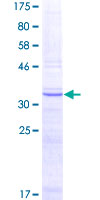 FUT7 Protein - 12.5% SDS-PAGE Stained with Coomassie Blue.