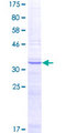 FUT7 Protein - 12.5% SDS-PAGE Stained with Coomassie Blue.