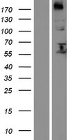 FUT8 Protein - Western validation with an anti-DDK antibody * L: Control HEK293 lysate R: Over-expression lysate