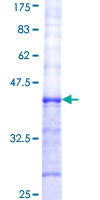 FUT8 Protein - 12.5% SDS-PAGE Stained with Coomassie Blue.