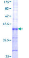 FUT8 Protein - 12.5% SDS-PAGE Stained with Coomassie Blue.