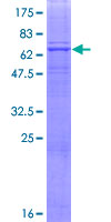 FUT9 Protein - 12.5% SDS-PAGE of human FUT9 stained with Coomassie Blue