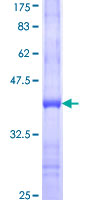 FUT9 Protein - 12.5% SDS-PAGE Stained with Coomassie Blue.