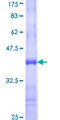 FUT9 Protein - 12.5% SDS-PAGE Stained with Coomassie Blue.