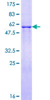 FVT1 / KDSR Protein - 12.5% SDS-PAGE of human FVT1 stained with Coomassie Blue