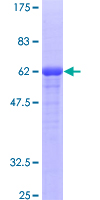 FVT1 / KDSR Protein - 12.5% SDS-PAGE of human FVT1 stained with Coomassie Blue