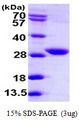 FVT1 / KDSR Protein