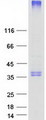 FVT1 / KDSR Protein - Purified recombinant protein KDSR was analyzed by SDS-PAGE gel and Coomassie Blue Staining