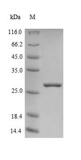 FXN / Frataxin Protein - (Tris-Glycine gel) Discontinuous SDS-PAGE (reduced) with 5% enrichment gel and 15% separation gel.