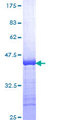 FXN / Frataxin Protein - 12.5% SDS-PAGE Stained with Coomassie Blue.