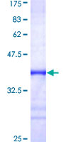FXR1 Protein - 12.5% SDS-PAGE Stained with Coomassie Blue.