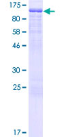FXR2 Protein - 12.5% SDS-PAGE of human FXR2 stained with Coomassie Blue