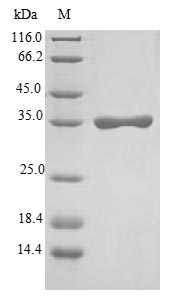 FXYD2 Protein - (Tris-Glycine gel) Discontinuous SDS-PAGE (reduced) with 5% enrichment gel and 15% separation gel.