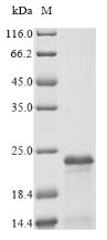 FXYD3 Protein - (Tris-Glycine gel) Discontinuous SDS-PAGE (reduced) with 5% enrichment gel and 15% separation gel.