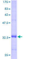 FXYD3 Protein - 12.5% SDS-PAGE of human FXYD3 stained with Coomassie Blue
