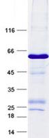 FXYD5 / Dysadherin Protein