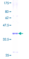 FXYD6 Protein - 12.5% SDS-PAGE of human FXYD6 stained with Coomassie Blue