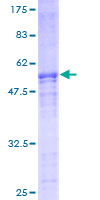 FYCO1 Protein - 12.5% SDS-PAGE of human FYCO1 stained with Coomassie Blue