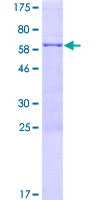 FYTTD1 Protein - 12.5% SDS-PAGE of human FYTTD1 stained with Coomassie Blue