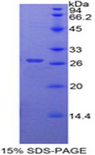 FZD1 / Frizzled 1 Protein - Recombinant Frizzled Homolog 1 By SDS-PAGE