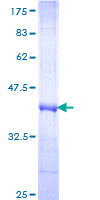 FZD3 / Frizzled 3 Protein - 12.5% SDS-PAGE Stained with Coomassie Blue.