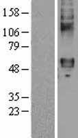 FZD4 / Frizzled 4 Protein - Western validation with an anti-DDK antibody * L: Control HEK293 lysate R: Over-expression lysate