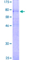 FZD4 / Frizzled 4 Protein - 12.5% SDS-PAGE of human FZD4 stained with Coomassie Blue