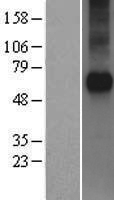 FZD5 / Frizzled 5 Protein - Western validation with an anti-DDK antibody * L: Control HEK293 lysate R: Over-expression lysate