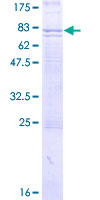 FZD5 / Frizzled 5 Protein - 12.5% SDS-PAGE of human FZD5 stained with Coomassie Blue