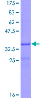 FZD5 / Frizzled 5 Protein - 12.5% SDS-PAGE Stained with Coomassie Blue.