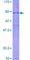 FZD7 / Frizzled 7 Protein - 12.5% SDS-PAGE of human FZD7 stained with Coomassie Blue