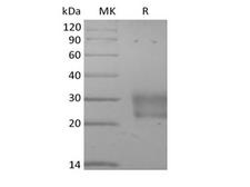 FZD8 / Frizzled 8 Protein - Recombinant Human Frizzled-8 (C-6His)
