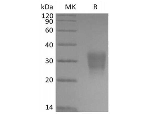 FZD8 / Frizzled 8 Protein - Recombinant Human Frizzled-8 (C-6His-Avi) Biotinylated