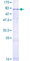 FZR1 Protein - 12.5% SDS-PAGE of human FZR1 stained with Coomassie Blue