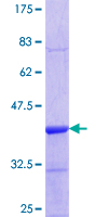FZR1 Protein - 12.5% SDS-PAGE Stained with Coomassie Blue.