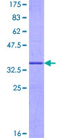 G0S2 Protein - 12.5% SDS-PAGE of human G0S2 stained with Coomassie Blue