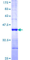 G2E3 / KIAA1333 Protein