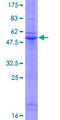 G5B / LY6G5B Protein - 12.5% SDS-PAGE of human LY6G5B stained with Coomassie Blue