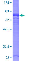 G6PC / Glucose-6-Phosphatase Protein - 12.5% SDS-PAGE of human G6PC stained with Coomassie Blue