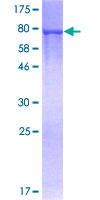 G6PD Protein - 12.5% SDS-PAGE of human G6PD stained with Coomassie Blue