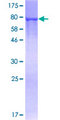 G6PD Protein - 12.5% SDS-PAGE of human G6PD stained with Coomassie Blue