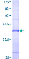 G6PD Protein - 12.5% SDS-PAGE Stained with Coomassie Blue.