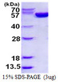 G6PD Protein