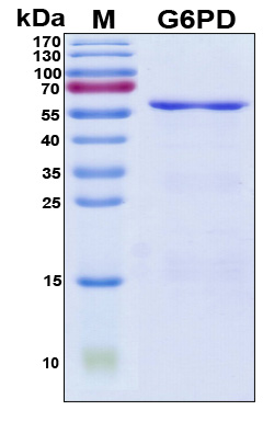 G6PD Protein