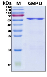 G6PD Protein