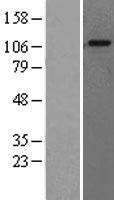 GAA / Alpha-Glucosidase, Acid Protein - Western validation with an anti-DDK antibody * L: Control HEK293 lysate R: Over-expression lysate